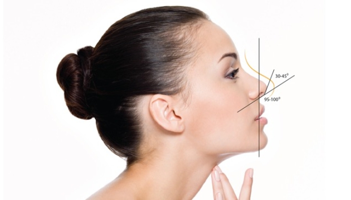 Nâng mũi chỉ tự tiêu có an toàn và hiệu quả hay không?